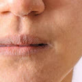 Dry Skin